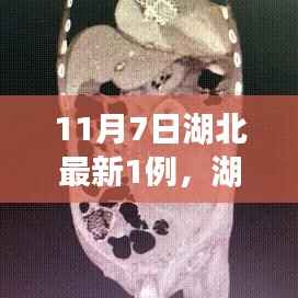 第1556页