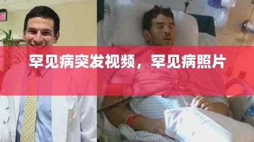 罕见病突发视频,罕见病照片